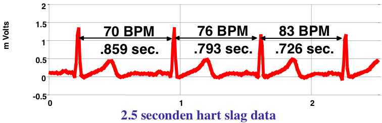 hartcoherentie